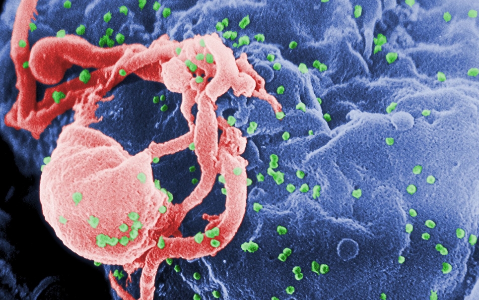 "Edição" no DNA pode ser arma contra o vírus da AIDS
