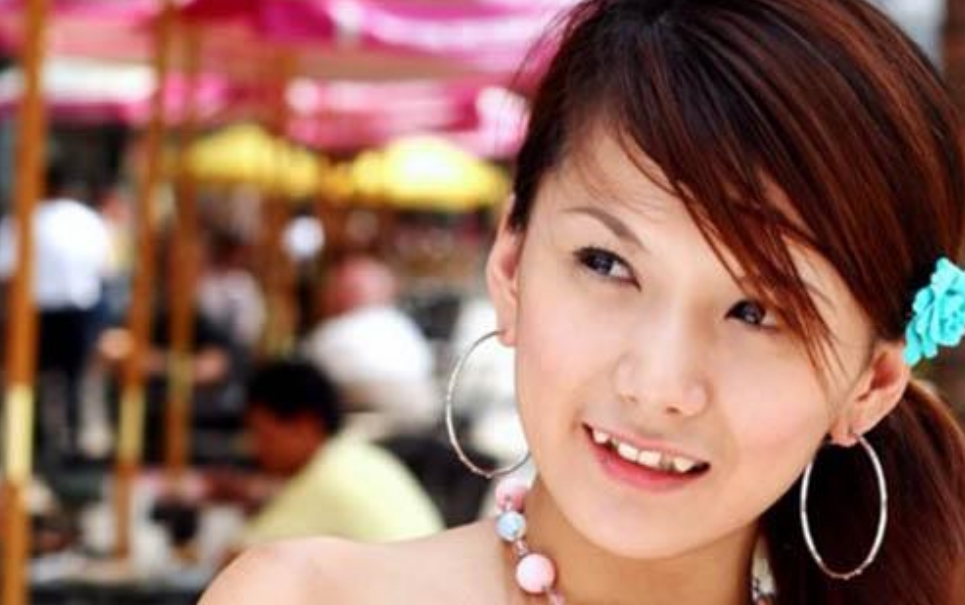 Dentistas pasmem: nova moda no Japão é ter dentes tortos