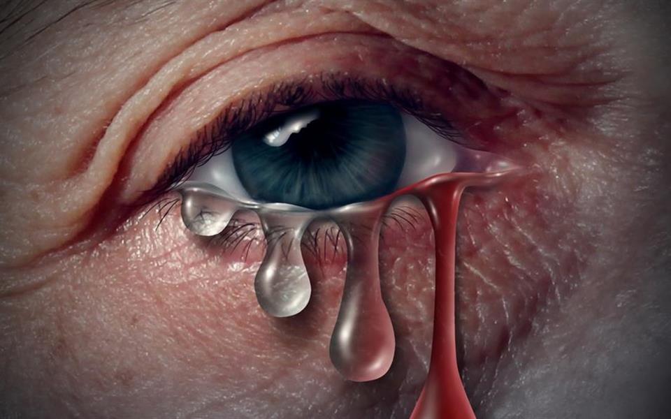 Conheça Michael Spann, o homem capaz de chorar sangue