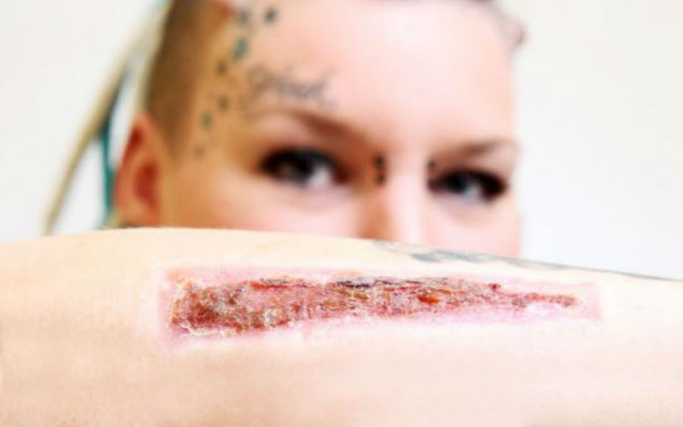 Jovem traída corta tatuagem e manda o pedaço de pele para o ex pelo correio