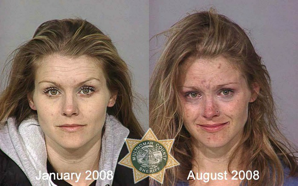 Fotos de usuários antes e depois mostram o efeito devastador das drogas
