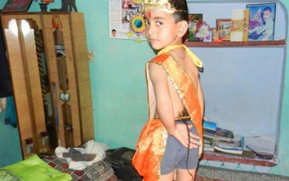 Menino com cauda de 30 cm é adorado como deus na Índia