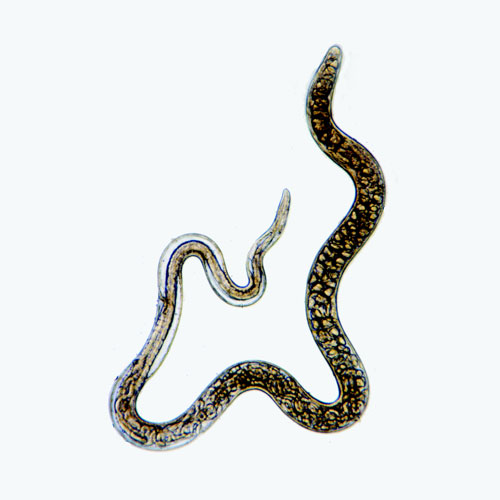 Ser humano de ascarid helminth