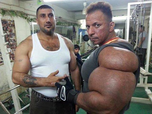 Retirar um lugar de pigmentary em uma cara na criança