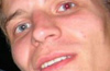 Logo Red Eye Remover Ícone Logo Red Eye Remover Ícone
