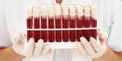 Imagem de: Arroz geneticamente modificado pode gerar sangue humano