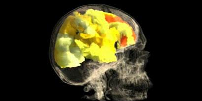 Imagem de: Como funciona o cérebro de uma mulher durante o sexo?