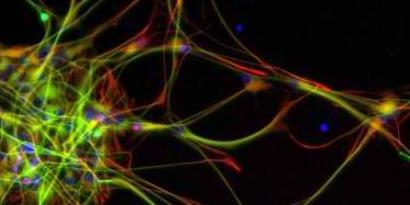 Imagem de: Meio homem, meio animal: cientistas implantam células humanas em rato