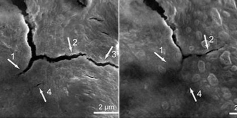 Imagem de: Bateria do futuro pode contar com "poder de cura"