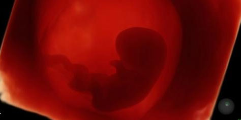 Novo Metodo De Ultrassom Mostra Imagens De Bebes Em 3d E Hd Tecmundo