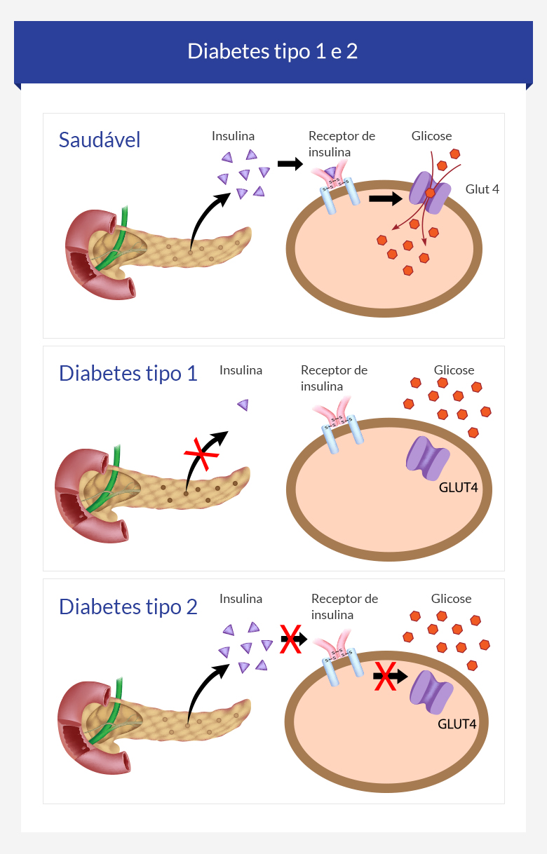 Desejo E Diabetes Falta De