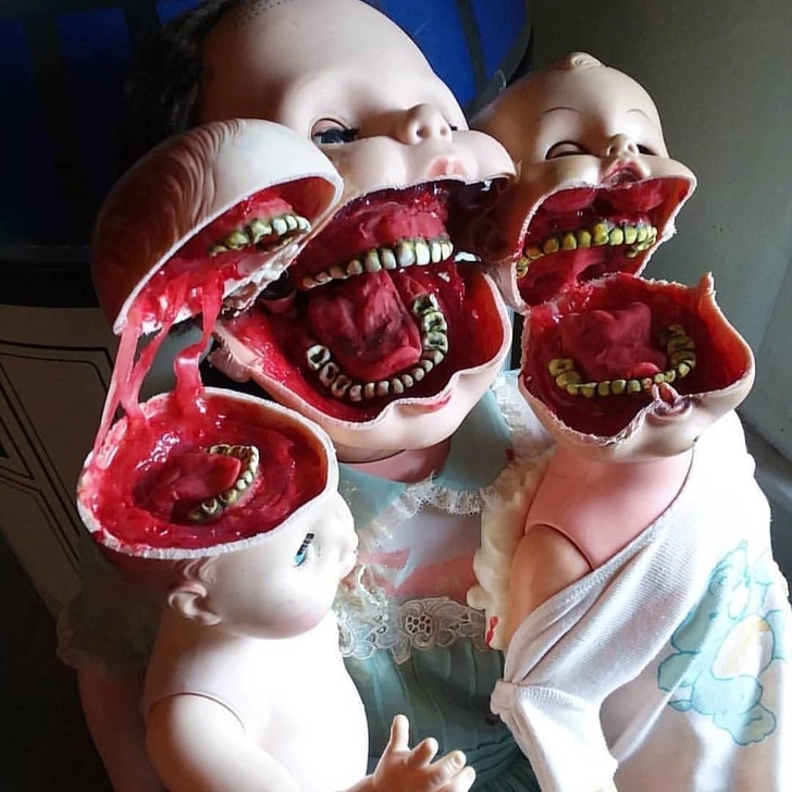 dentes