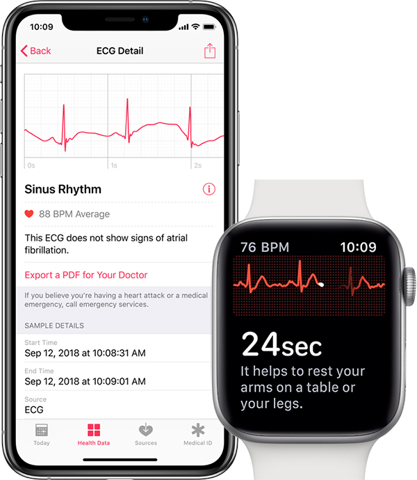 função ecg apple watch