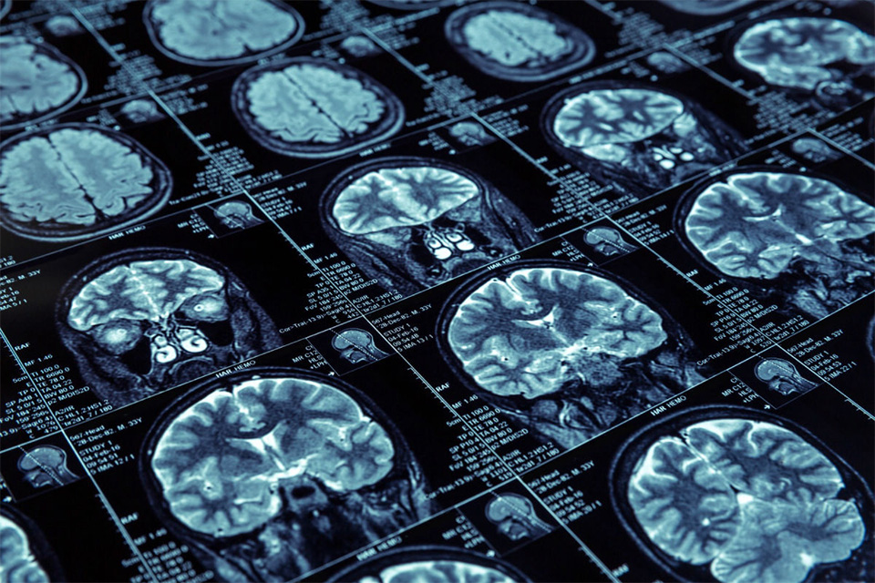 Imagem de: Philips está desenvolvendo algoritmos e IAs para diagnosticar câncer