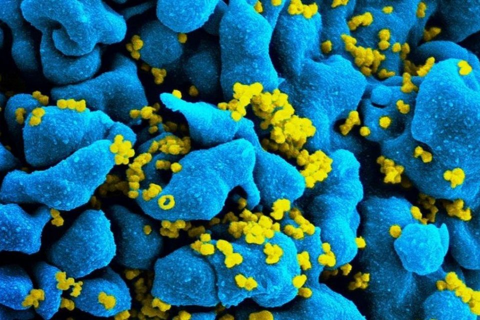 HIV: descoberta segunda mutação em gene que torna células imunes ao vírus