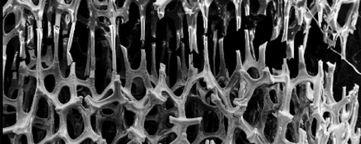 Imagem de: Nova técnica permite que metais se “regenerem” como ossos humanos