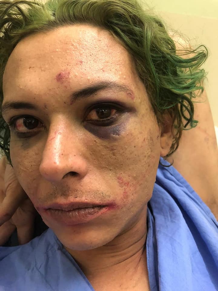Cosplayer diz ter sido torturado por seguranças durante a Brasil Game Show