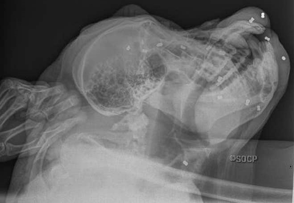 Orangotango sobrevive após ser atacado a balas em Sumatra