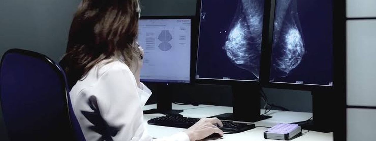 IA da Google supera especialistas na detecção do câncer de mama - TecMundo
