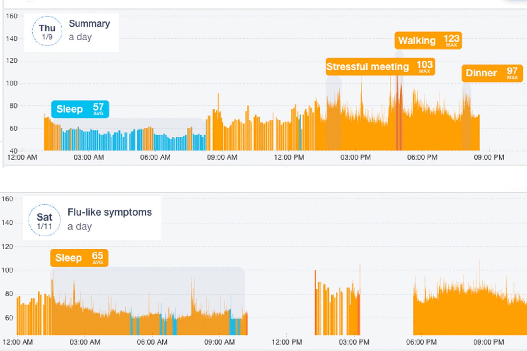 Graphics displayed on cardiogram