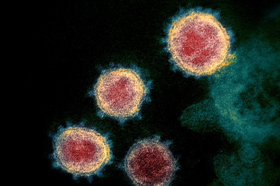 Imunidade à covid-19 é maior do que indicam os testes, diz estudo