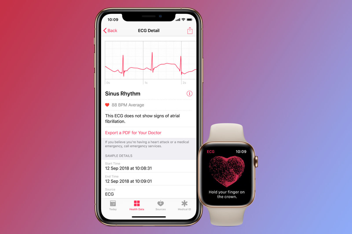 Apple libera iOS 13.6 com eletrocardiograma para Apple Watch no Brasil