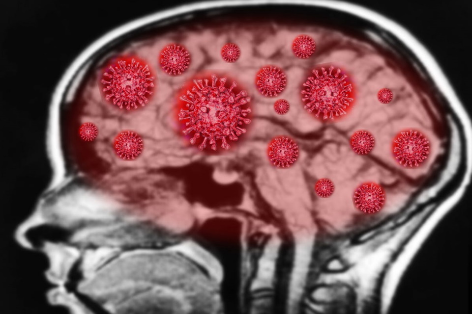 Estudo revela como o novo coronavírus pode infectar o cérebro
