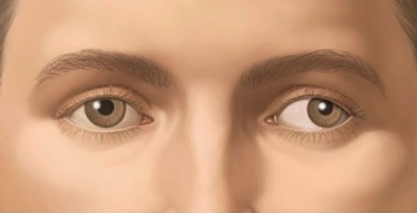 Fonte: Instituto de Olhos da Amazônia/Reprodução