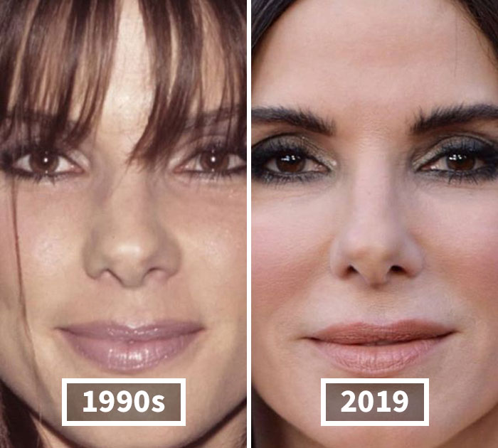 Fonte: celebbeforeafter/Instagram/Reprodução