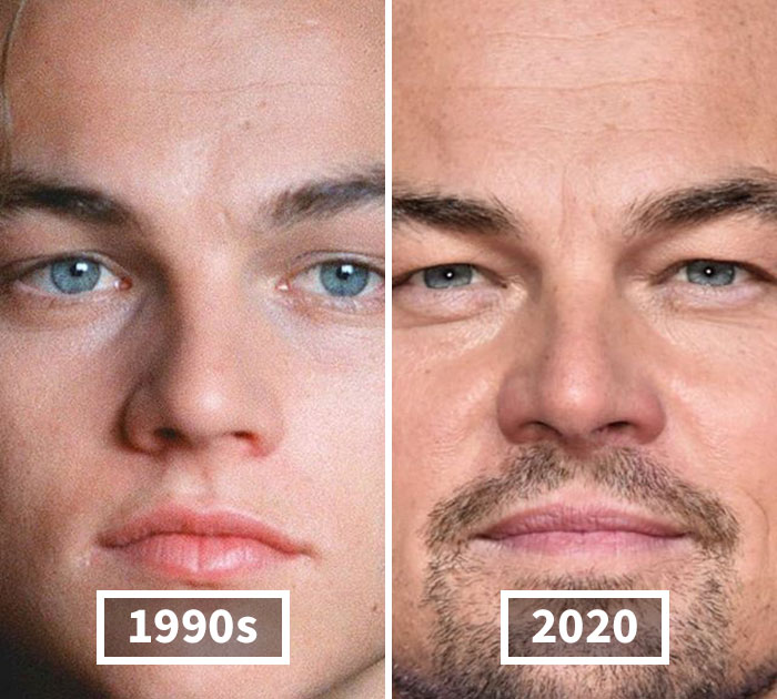 Fonte: celebbeforeafter/Instagram/Reprodução