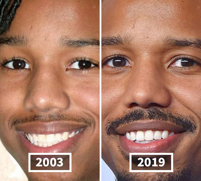 Fonte: celebbeforeafter/Instagram/Reprodução