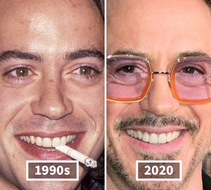 Fonte: celebbeforeafter/Instagram/Reprodução