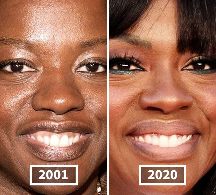 Fonte: celebbeforeafter/Instagram/Reprodução