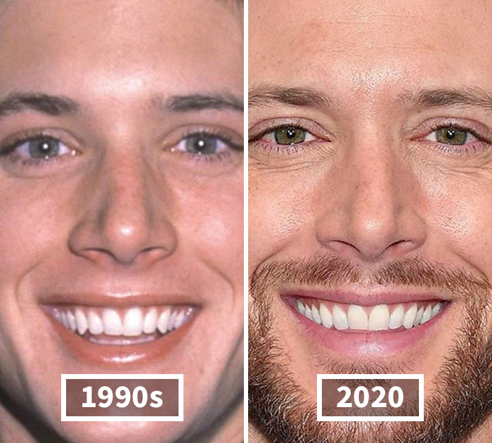 Fonte: celebbeforeafter/Instagram/Reprodução