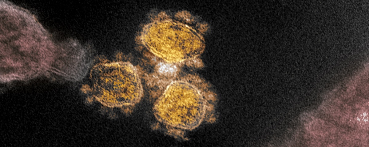Mortalidade da covid-19 pode estar ligada aos nossos genes