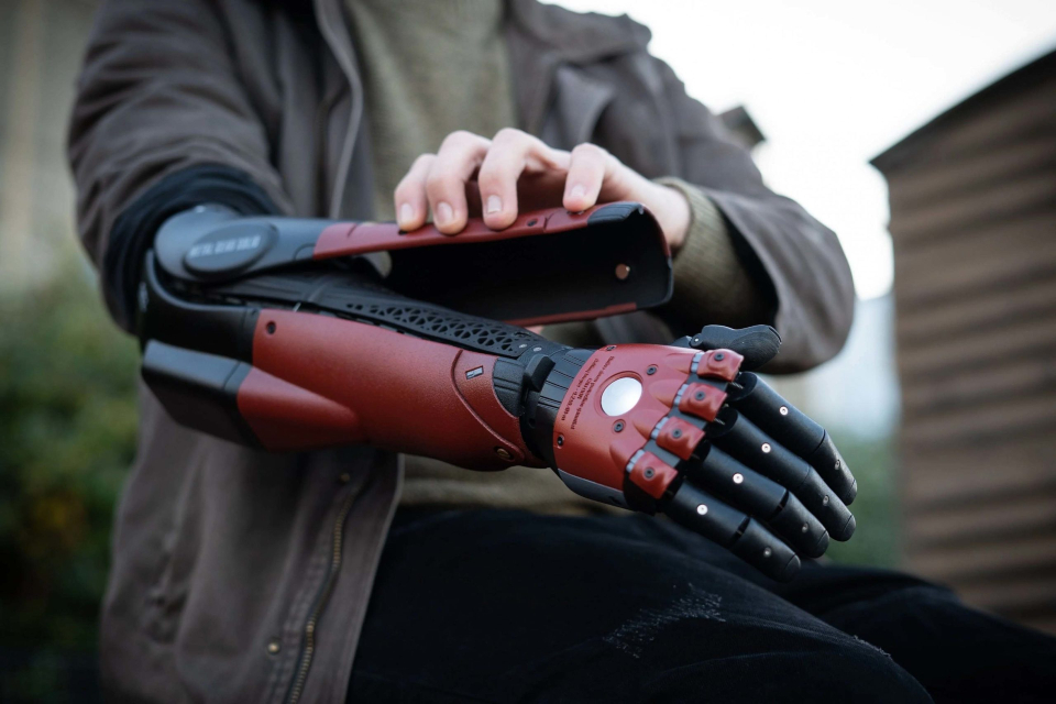 Rapaz recebe prótese inspirada no braço biônico de Metal Gear Solid