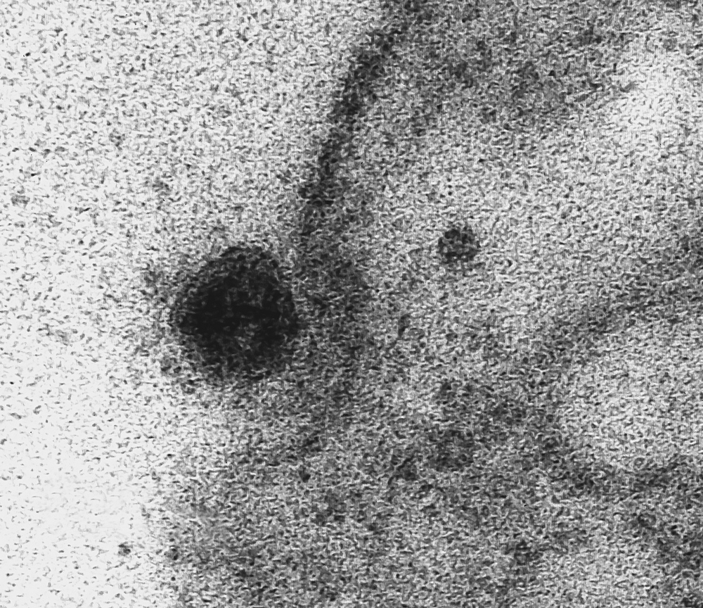 A mutação do coronavírus tornou mais eficiente a maneira com que o SARS-CoV-2 se liga à célula.