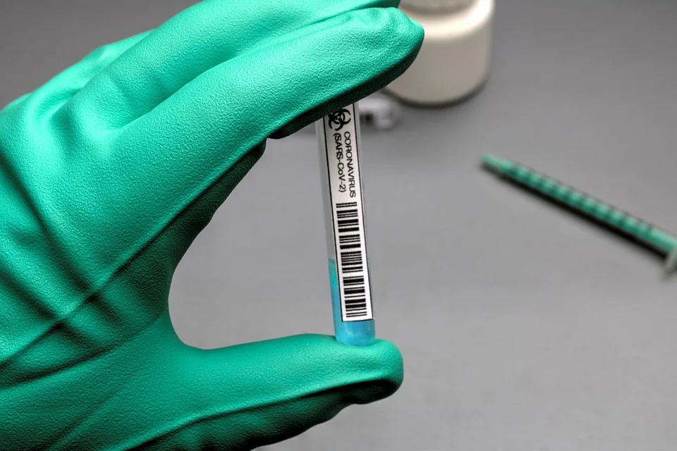'Superanticorpos' são a nova aposta para combater a covid-19