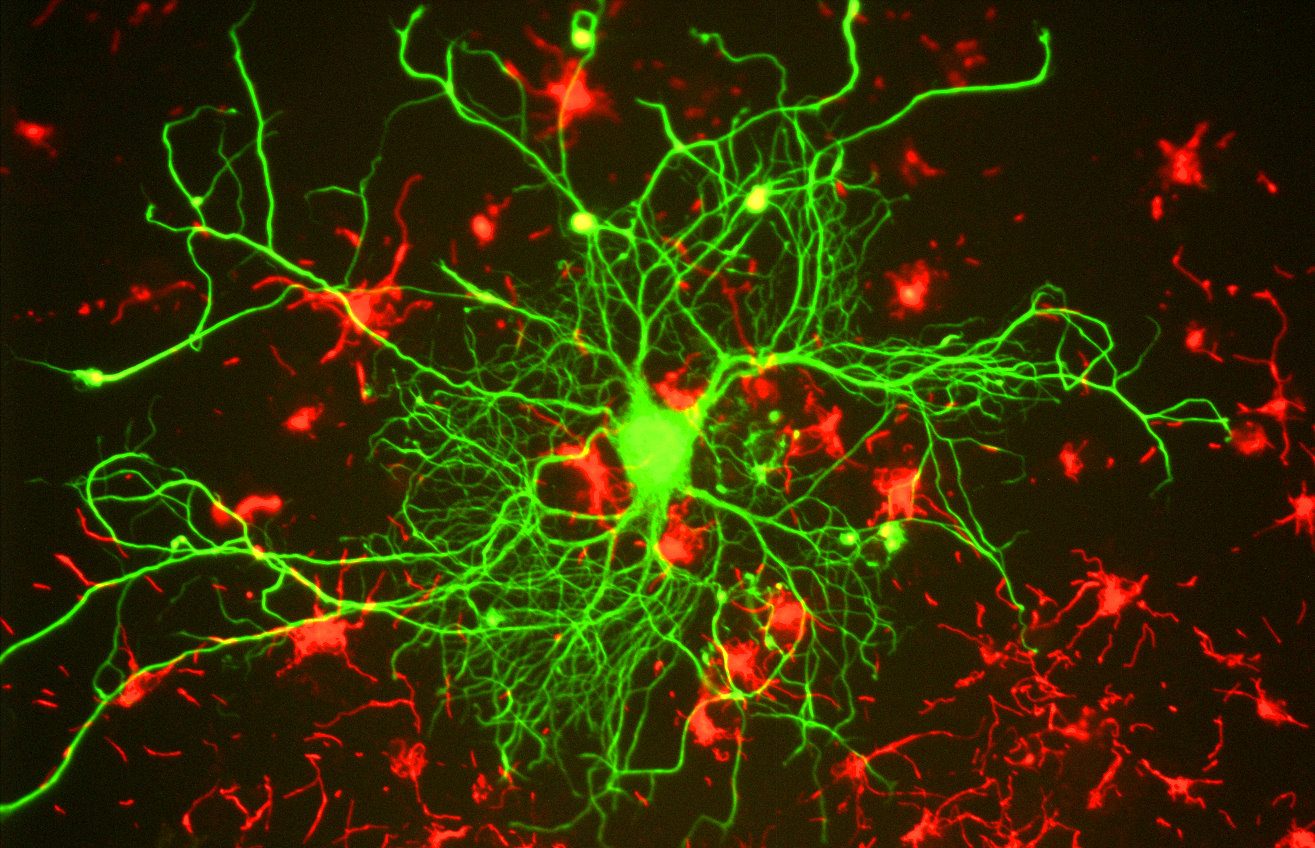 Células gliais, as "mortas-vivas" do cérebro humano.