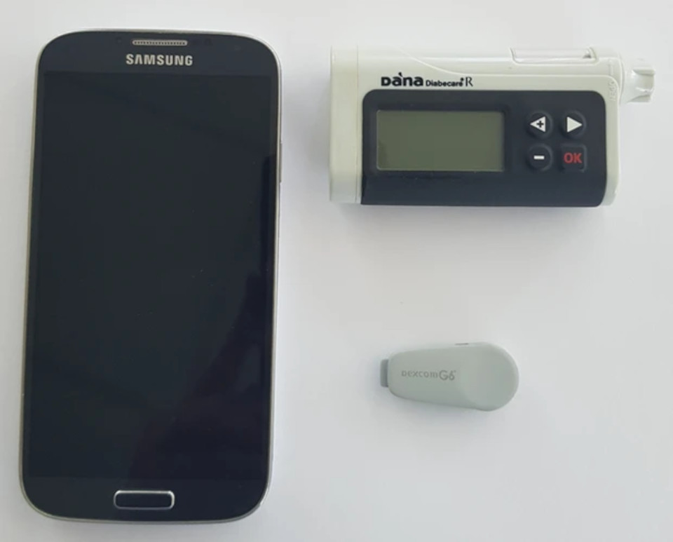 "Pâncreas artificial" é um sistema que tem três componentes: um sensor, uma bomba de insulina e um aplicativo de celular (Fonte: Universidade de Cambrigde/Divulgação)