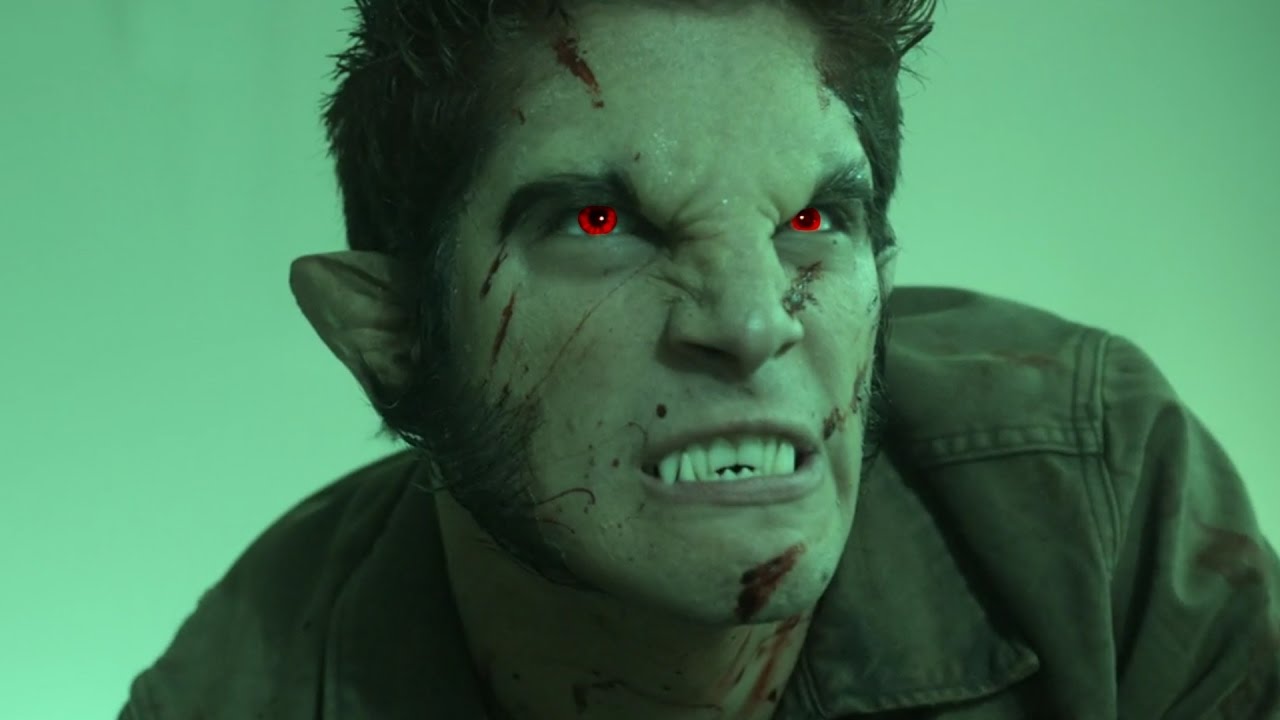 Teen Wolf (2011)