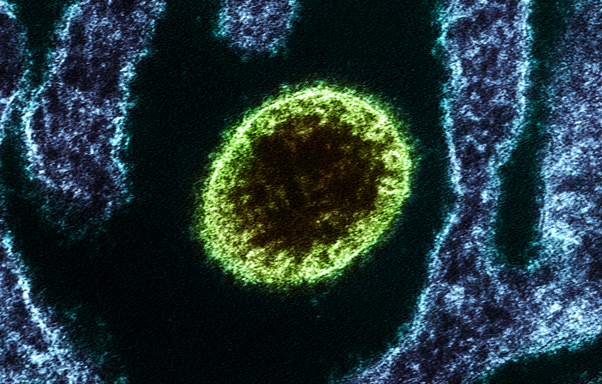 Partícula extracelular madura do vírus Nipah obtida por micrografia eletrônica  (Fonte: NIAID - Nipah Virus Particle/Wikimedia Commons/Reprodução)