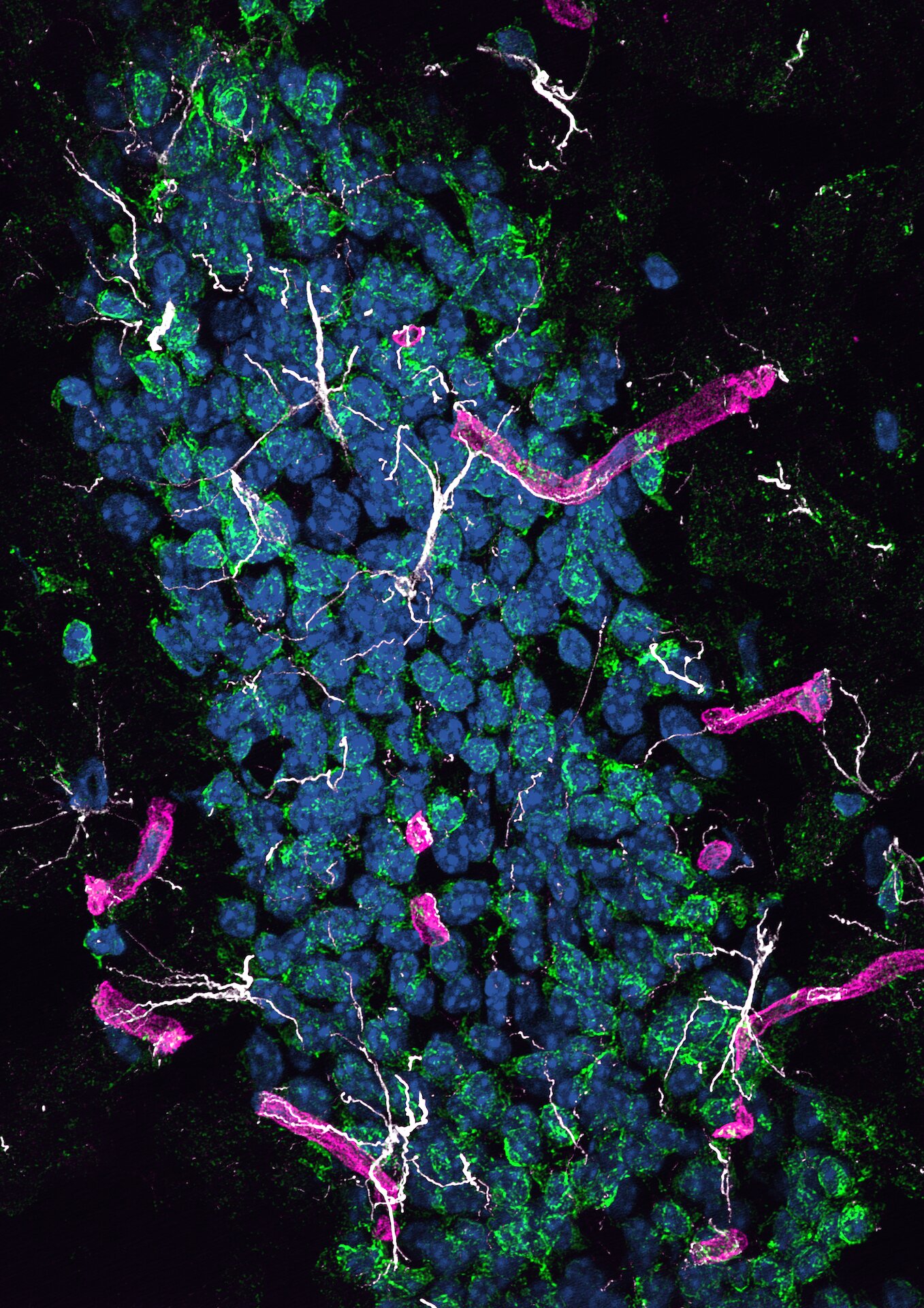 Imagem do hipocampo de um camundongo do estudo, que demostra a proteína (em verde) causando degeneração no tecido cerebral (em azul)