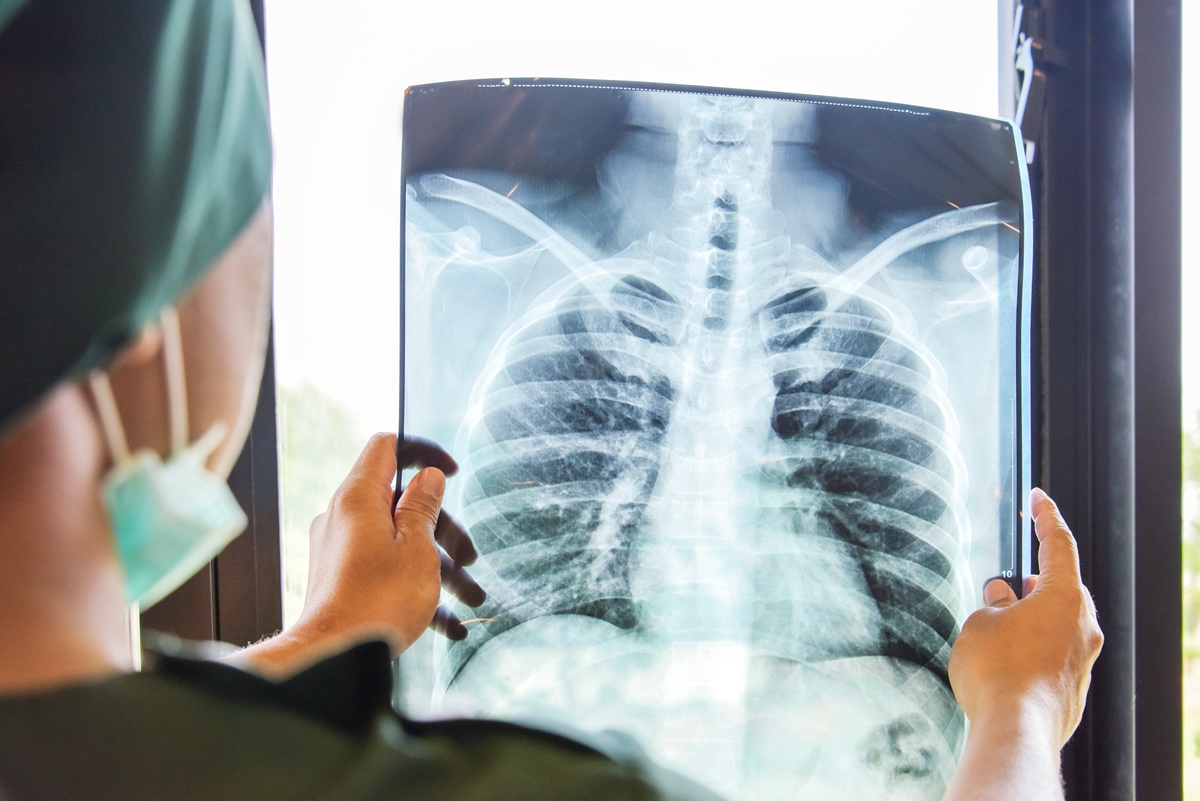 Doctor analyzes patient's chest x-ray