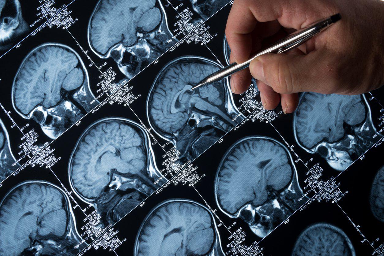 (Fonte: iStockPhoto).