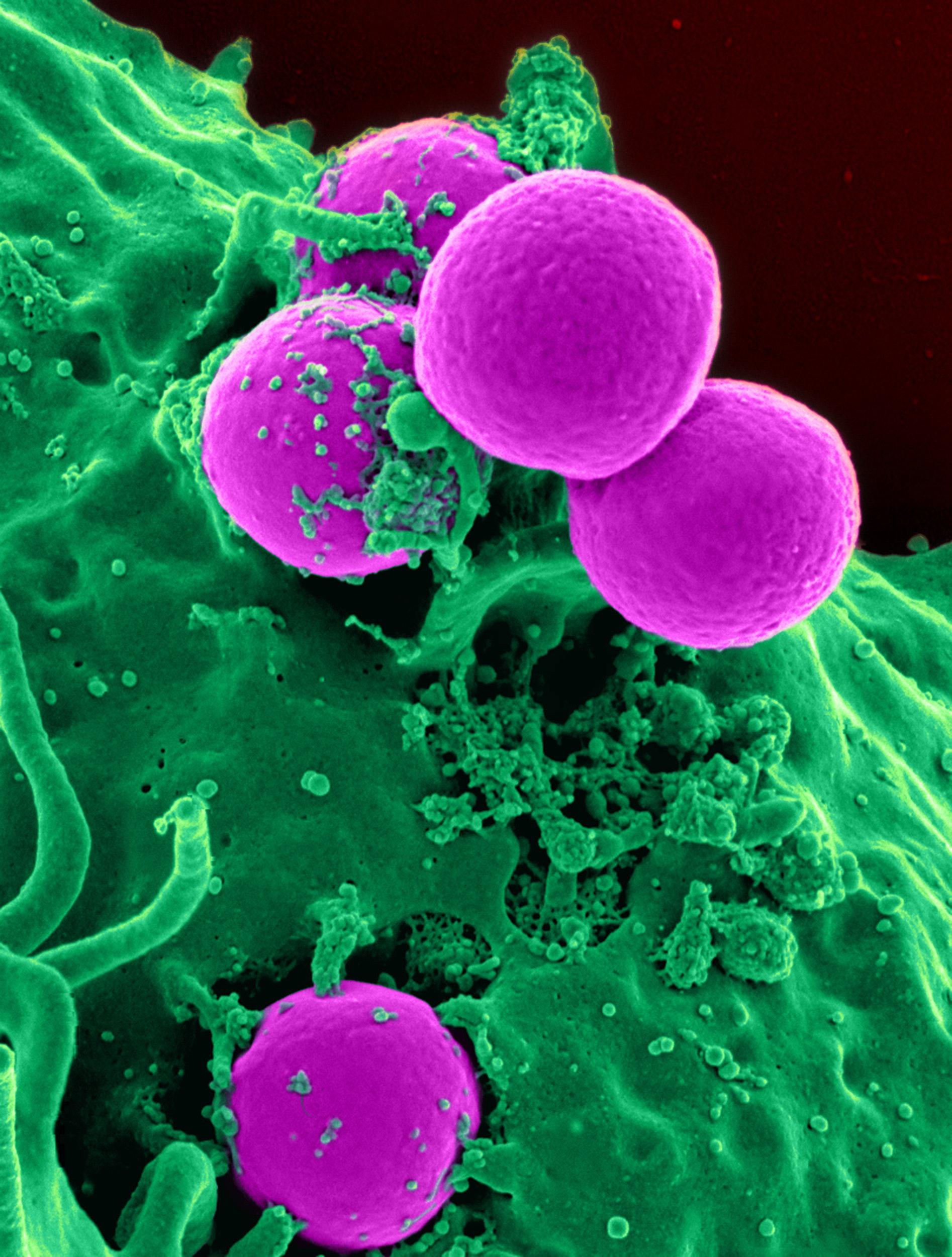 'Super bactérias' matam 1,2 milhão de pessoas por ano, mostra estudo
