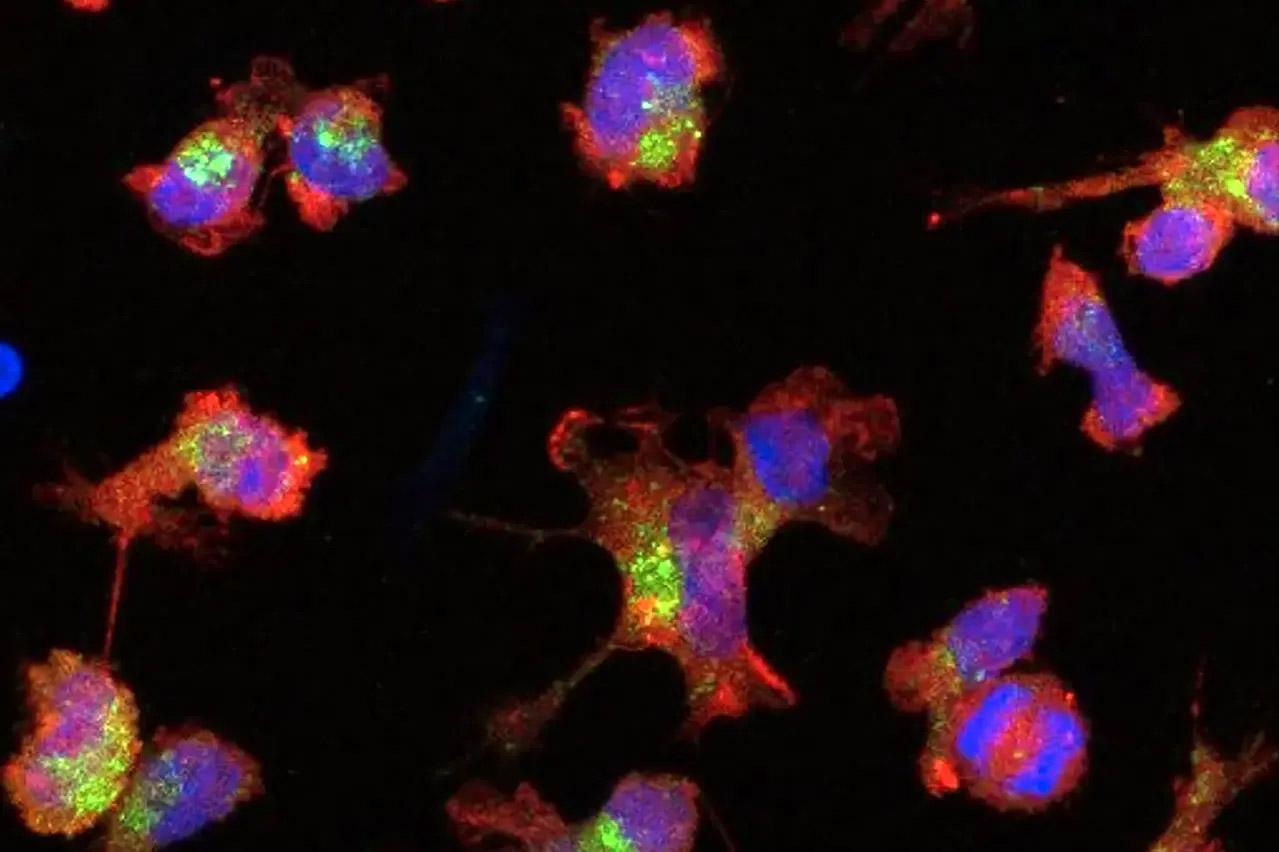 Células microgliais coloridas para estudo. (Fonte: LMU Klinikum/Reprodução.)