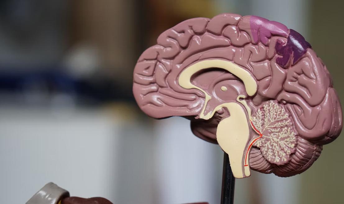 Parte do estudo está sendo realizado no Programa de Inteligência Artificial (IA) do Departamento de Neurologia da Mayo Clinic