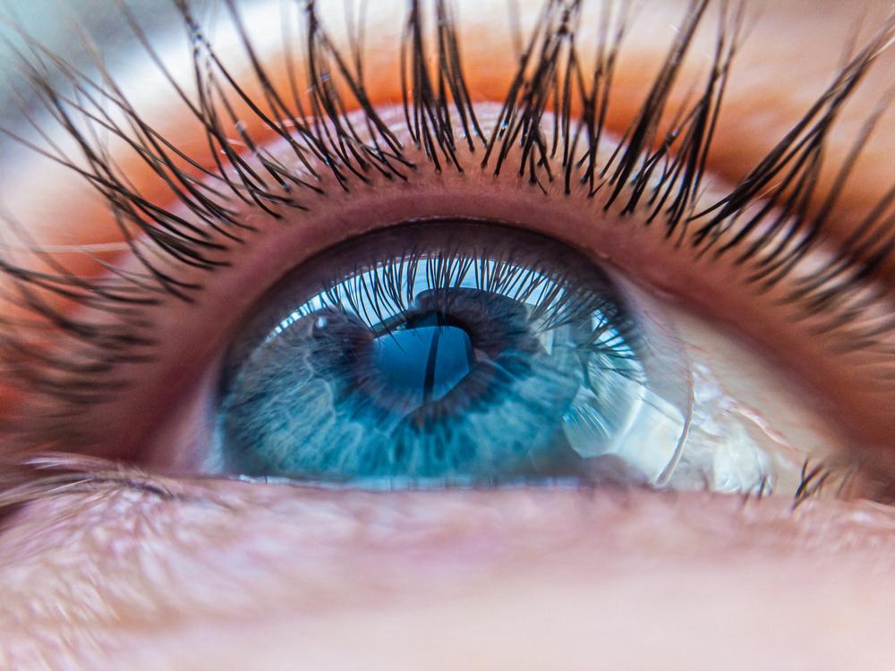 Lente de contato mede a pressão dos olhos e libera remédio para glaucoma