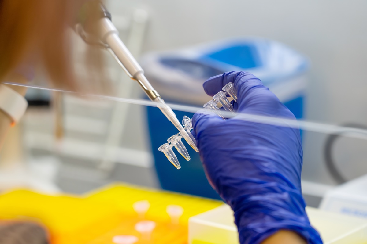 Brasil tem primeiro caso confirmado de varíola de macacos